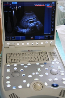Utrazvok in Doppler